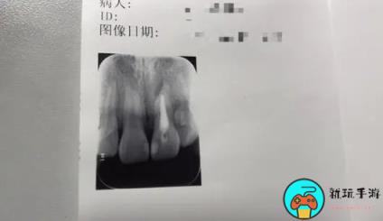 脆皮大学生是什么意思